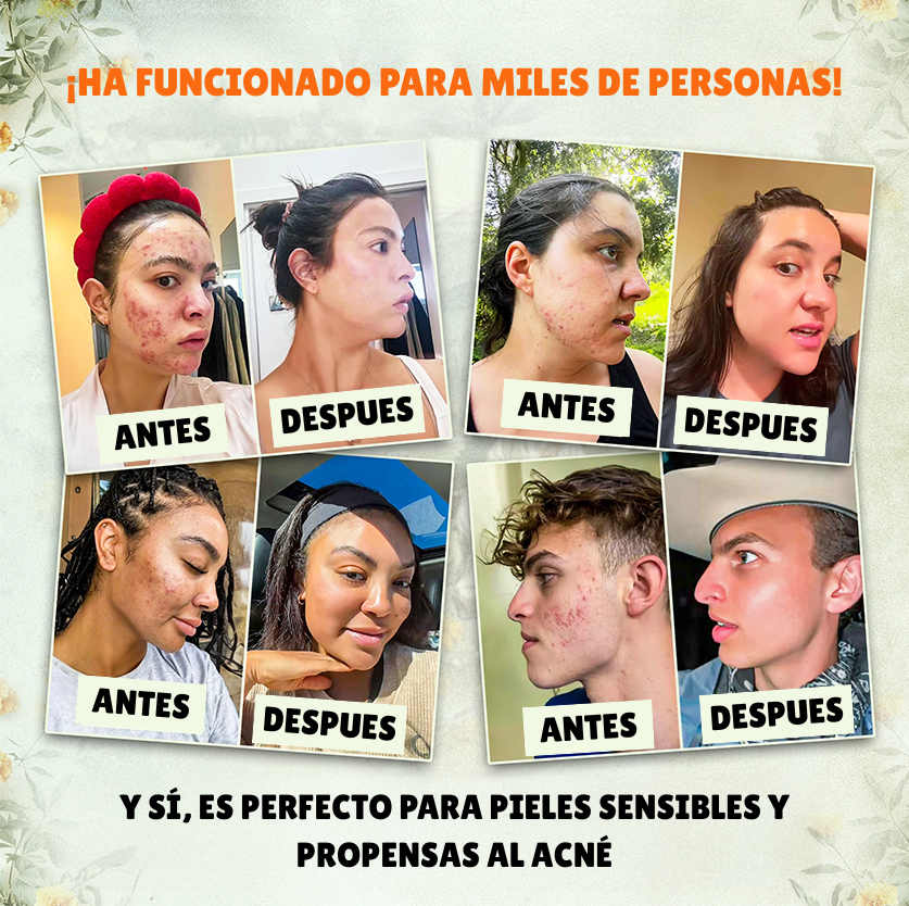 Merraci™ Bálsamo Natural de Sebo – 100% Puro, Sin Químicos, Todo Tipo de Piel